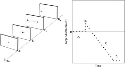 Impairment of Smooth Pursuit as a Marker of Early Multiple Sclerosis